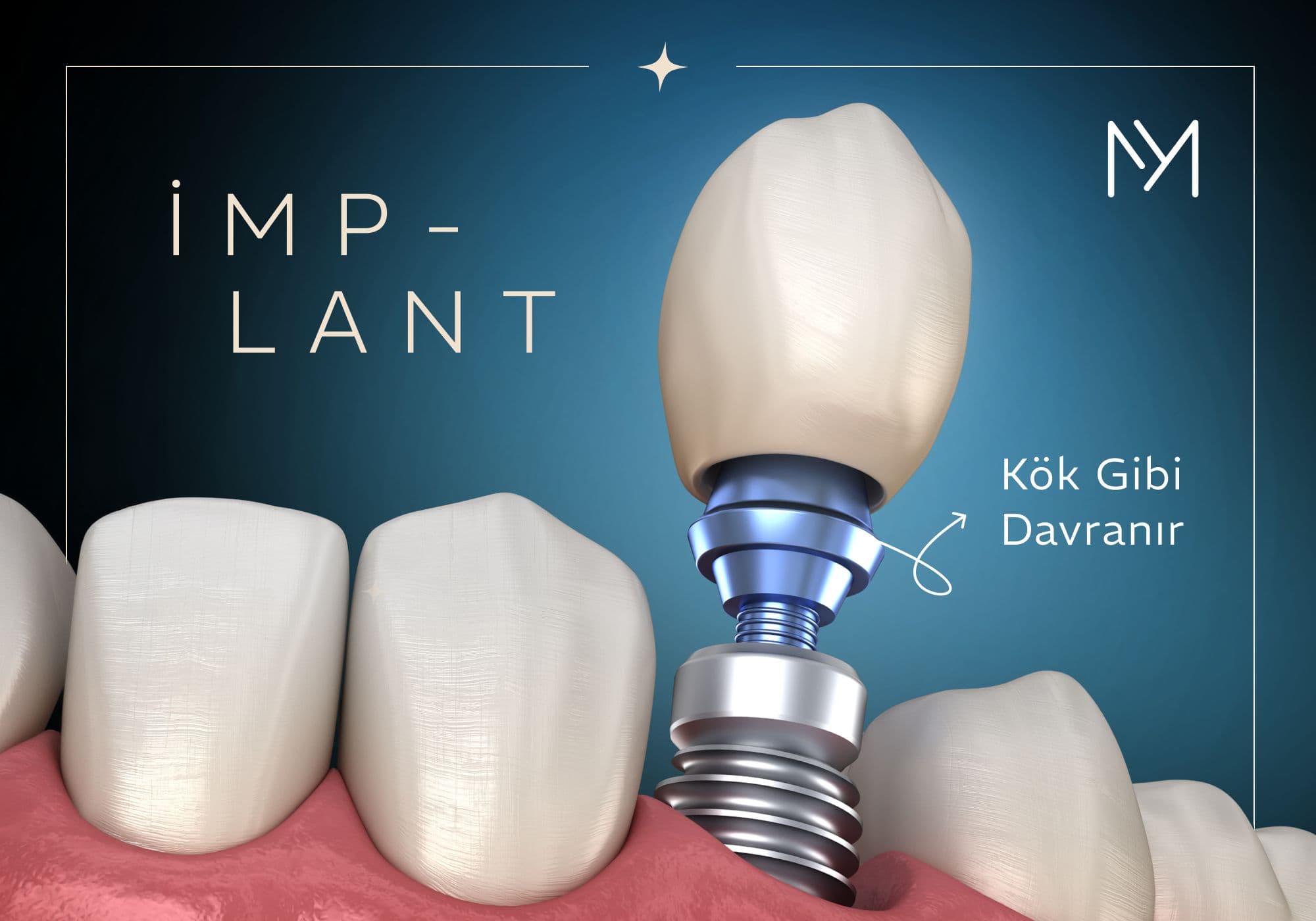 Dental implantoloji klinik görüntüsü