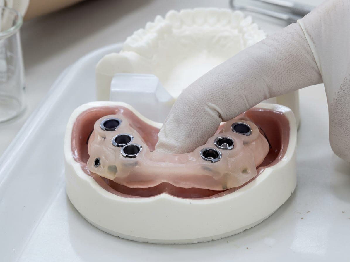 Rehberli implant cerrahisi