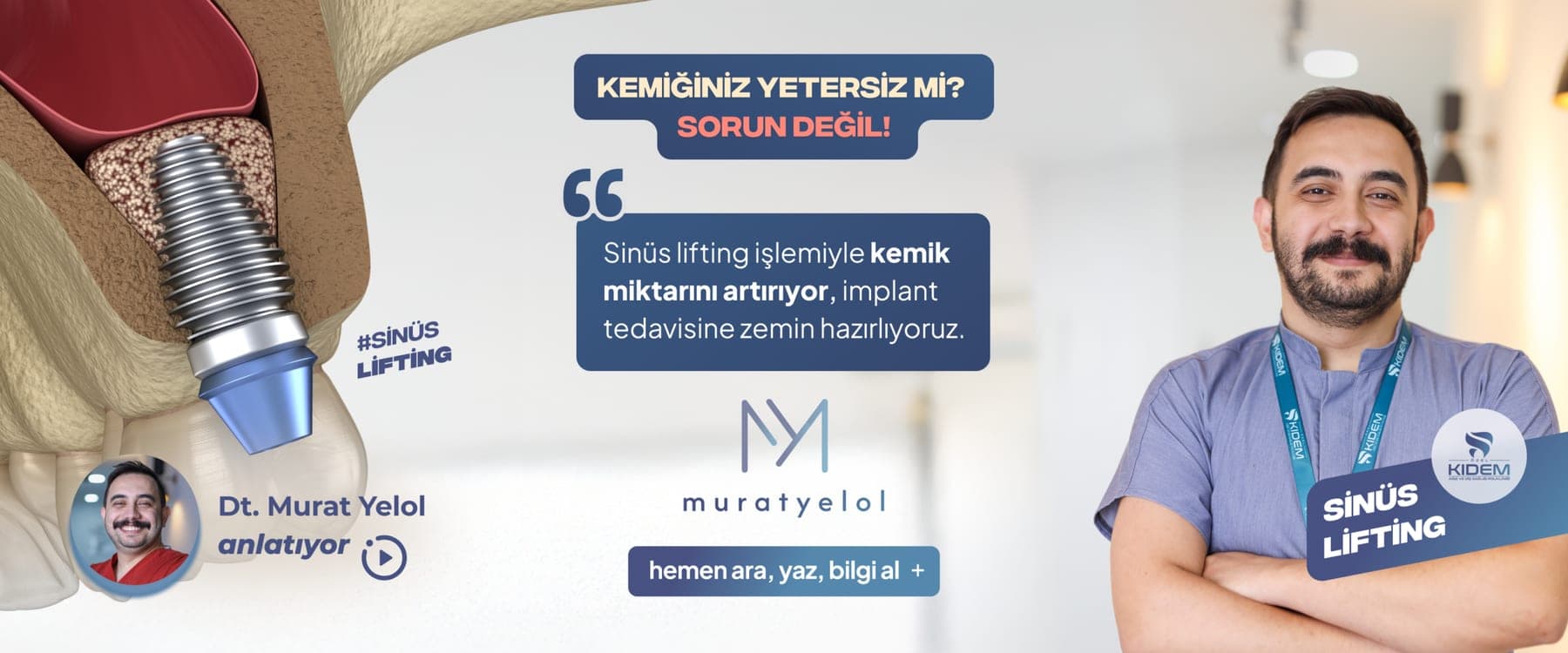 Sinüs lifting görseli